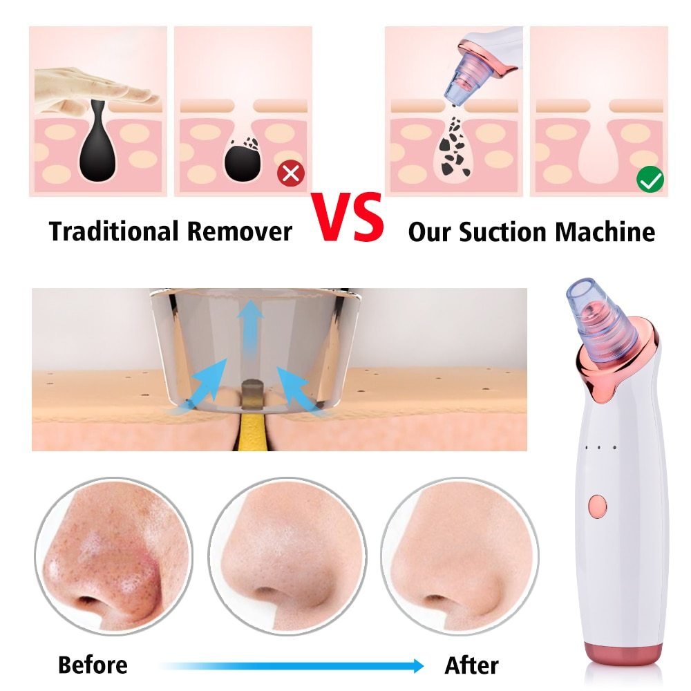 Electric Suction Facial Washing Instrument - Divine Janisal Design