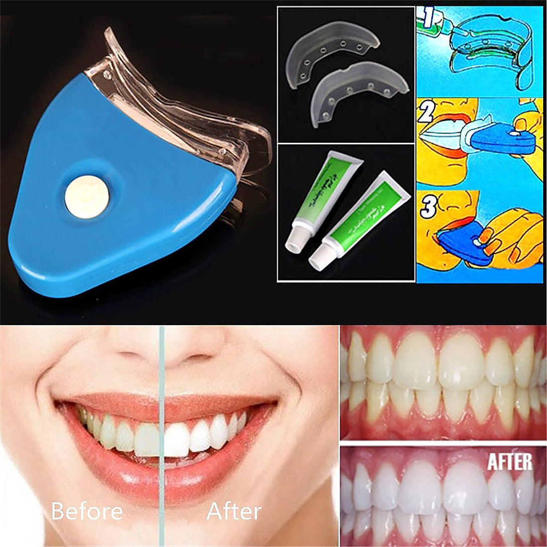 Teeth Whitening Oral Gel - Divine Janisal Design
